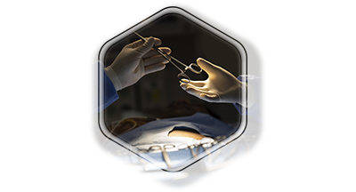 Vaso - Vasoanastomosis (Recanalización de conductos deferentes)