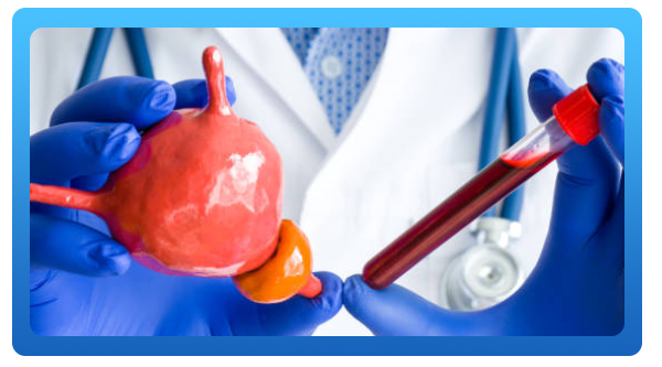 ¿Cual es el beneficio de acudir al urólogo?